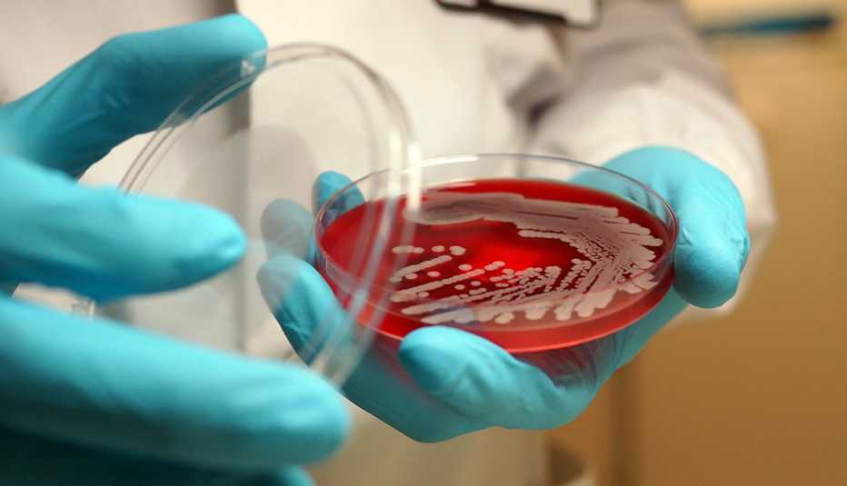 microbiologist examining growth of MRSA bacteria on a culture plate