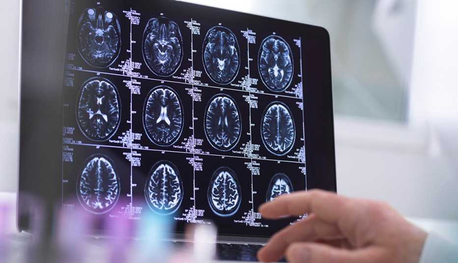 slides of human brain being analyzed for signs of cognitive impairment
