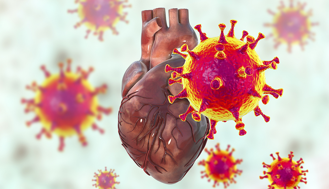 illustration of COVID-19 affecting a heart