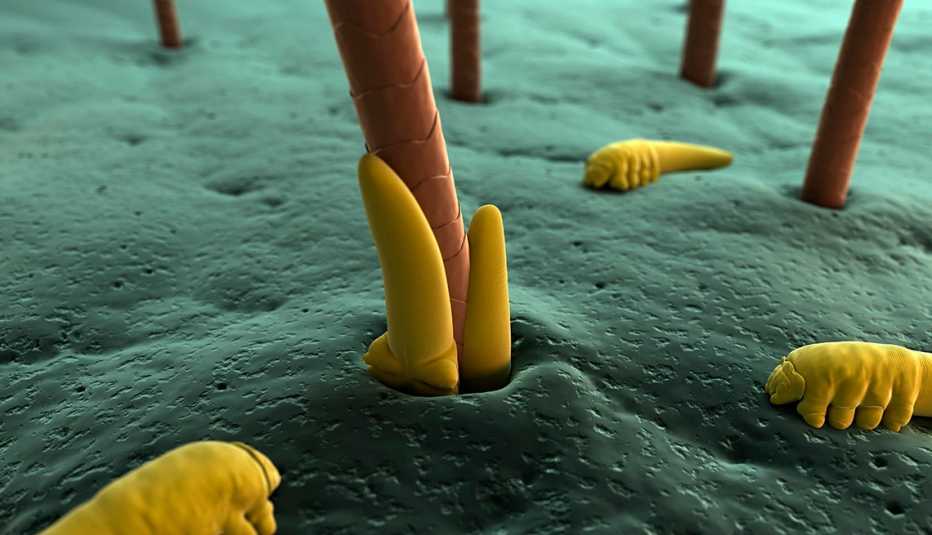 Illustration of eyelash mites on an eyelash follicle Illustration of eyelash mites on an eyelash follicle