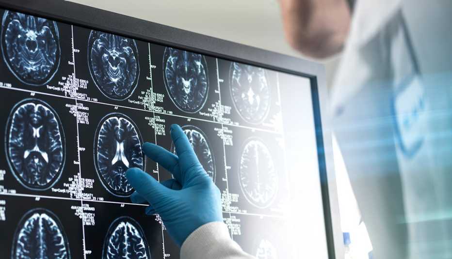 Doctor analyzing patients brain scan on screen Close up of a doctor wearing a blue surgical glove examining a brain scan on a computer screen