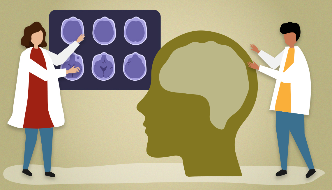 Two doctors studying a brain and brain scans for Alzheimers
