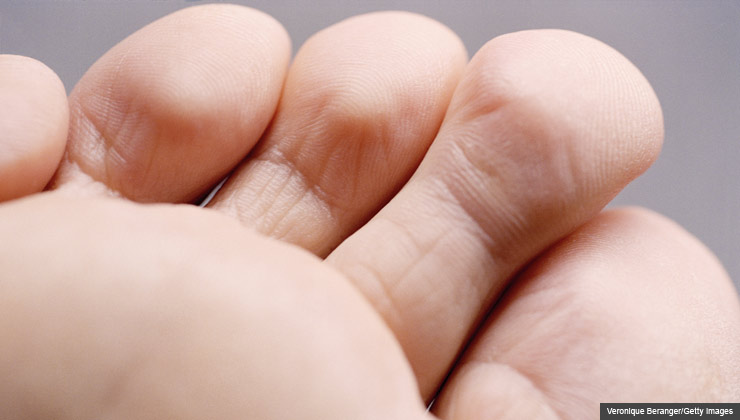 3. Myth: Gout pain always starts in the big toe Truth: It’s true that gout often first attacks the joints of the big toe, but that’s not always the case. In women with osteoarthritis, for example, gout pain commonly starts in the small joints of the hands. Although the first attacks often involves only one or two joints, over time multiple joints become affected. If the disease isn’t treated, it can cause permanent damage. For 8 Myths About Gout slideshow.