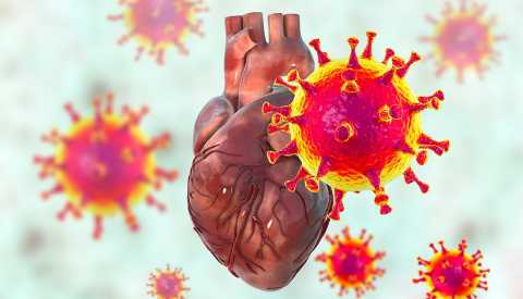 illustration of COVID-19 affecting a heart illustration of COVID-19 affecting a heart