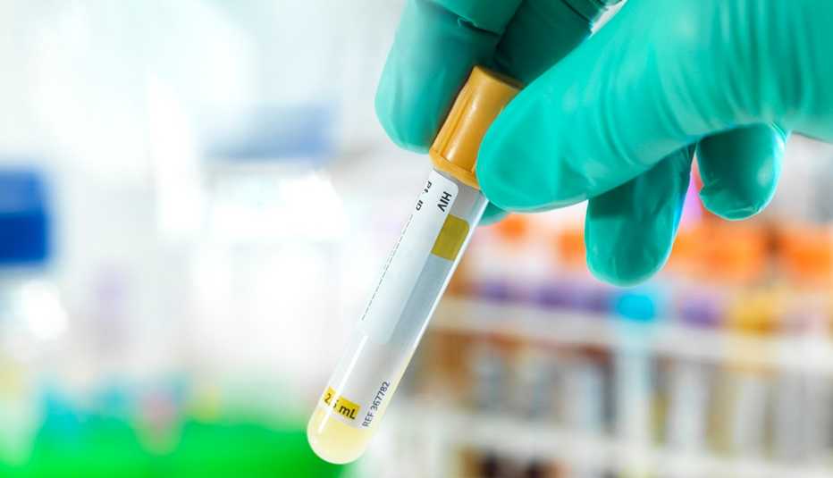 Doctor preparing a HIV test sample in a test tube