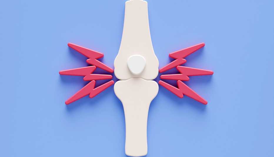 Rheumatoid arthritis, conceptual illustration