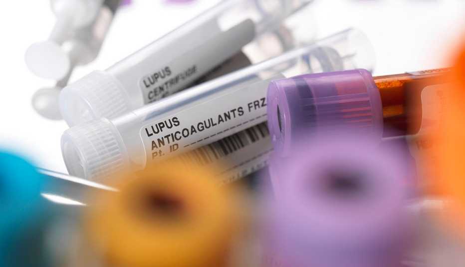 lupus anticoagulants on a surgical tray lupus anticoagulants on a surgical tray