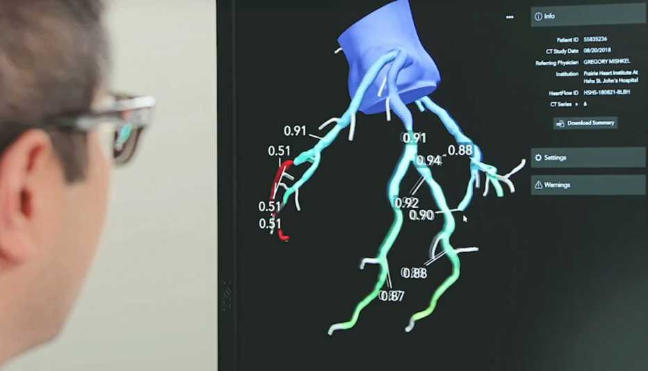 HeartFlow FFRct Analysis
