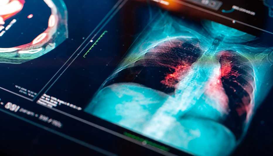 hi res image of an MRI scan on a digital screen