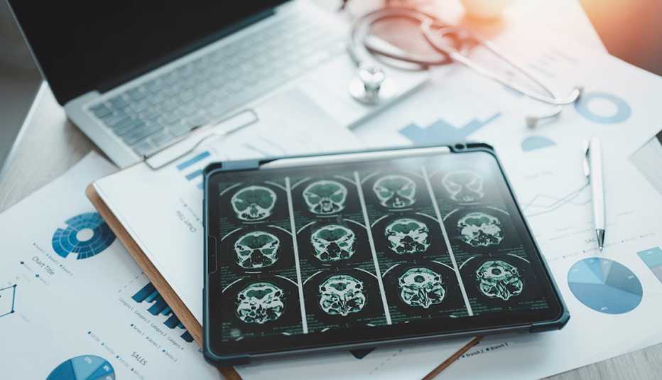 A digital tablet with brain scans on the screen