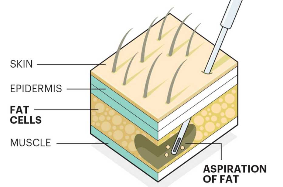 Stem Cells Stem Cells