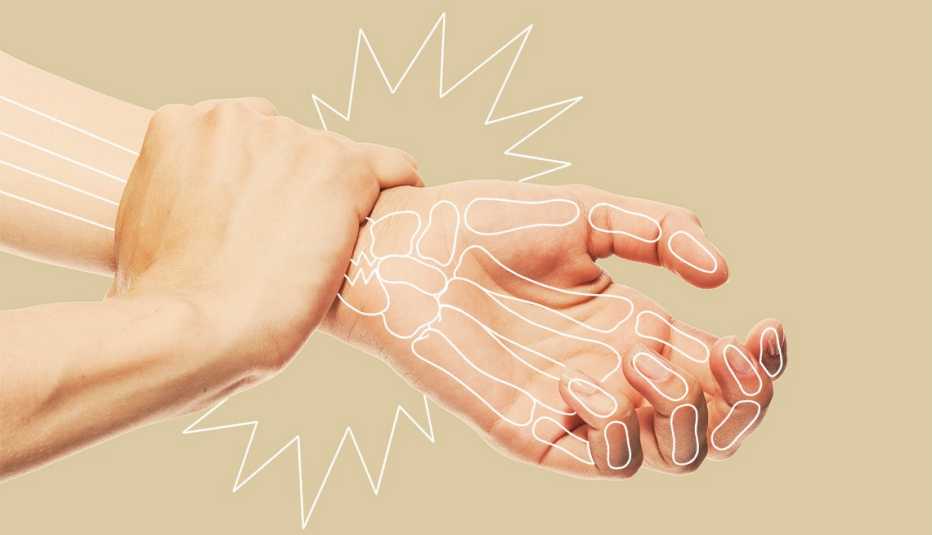 Hand clasping opposite wrist with bone drawing overlaid