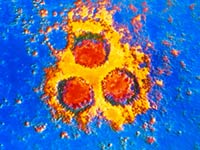 pneumococcal and herpes zoster (shingles) vaccine at the same time is beneficial