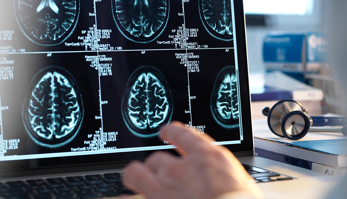 Brain scan on computer screen