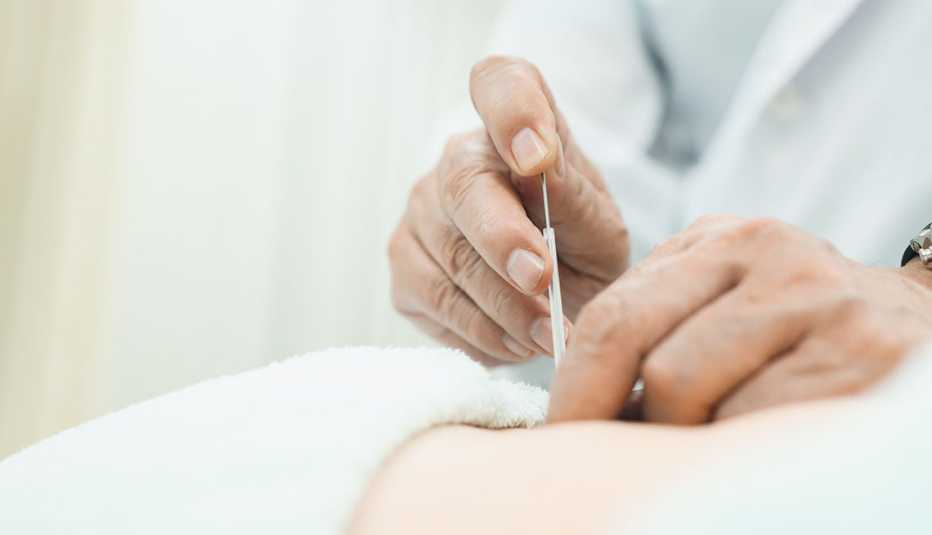 close up of acupuncture treatment