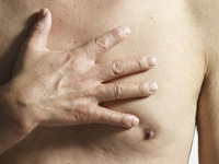 Man's chest - South Carolina man with breast cancer denied Medicaid.