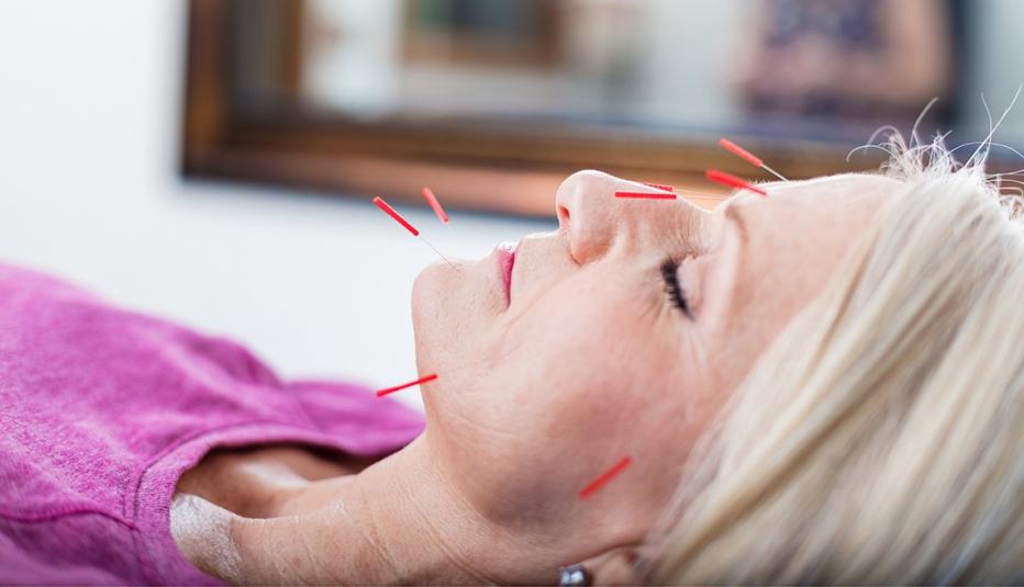 Older White Woman Receiving Acupuncture Treatment
