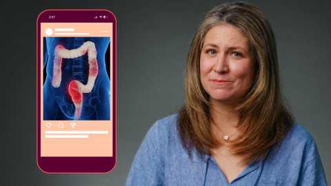 woman next to a digital illustration of the colon