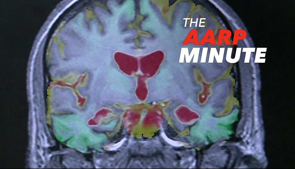 a scan of a brain