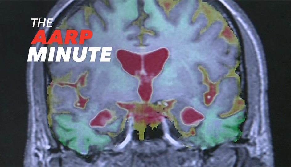 a scan of a brain