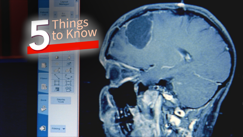 an x-ray of a scull. five things to know