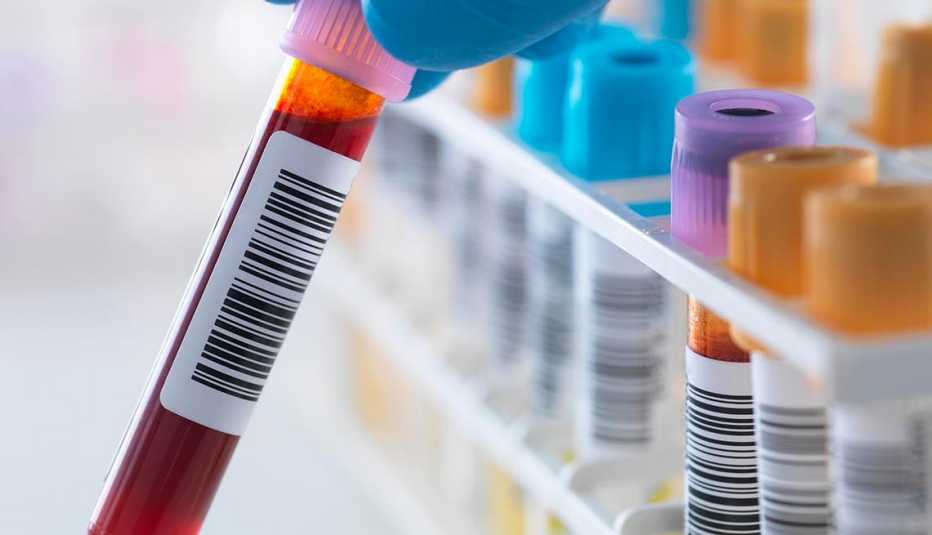 Tubos de ensayo con muestras de sangre