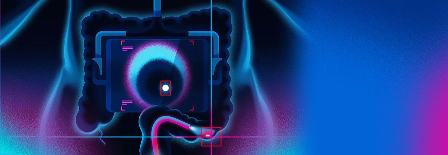 Ilustración digital de una radiografía intestinal Ilustración digital de una radiografía intestinal