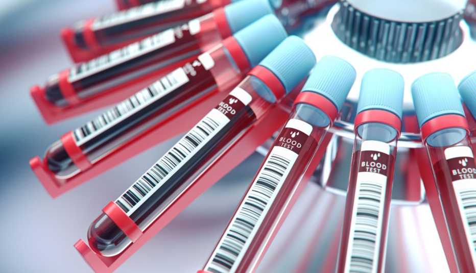 Tubos de ensayo con sangre Tubos de ensayo con sangre