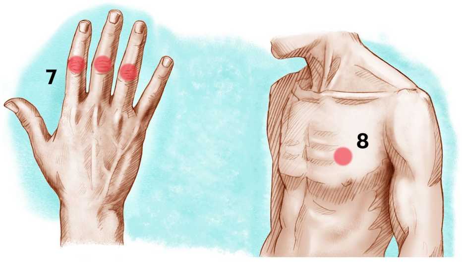 Artritis