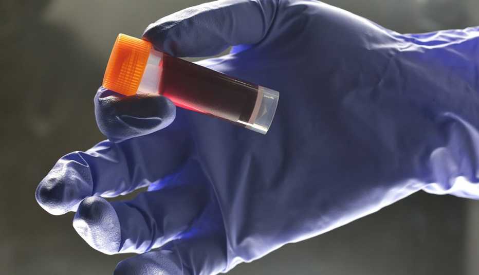 Mano con guante sosteniendo una muestra de sangre Mano con guante sosteniendo una muestra de sangre