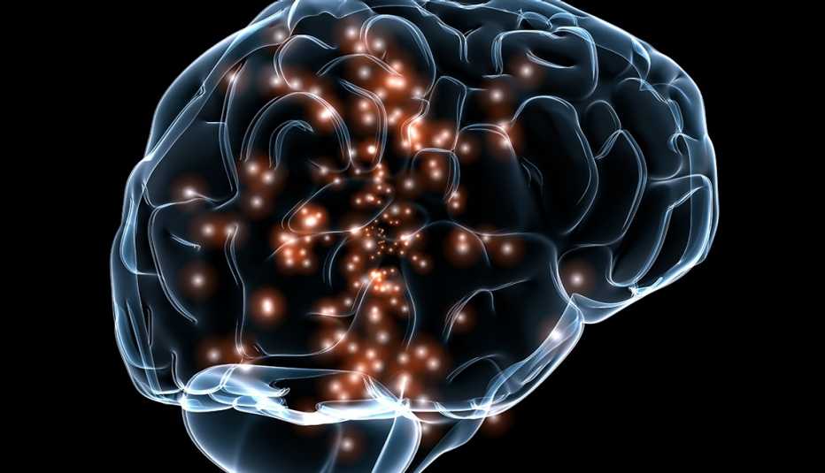 Gráfico de un cerebro activo