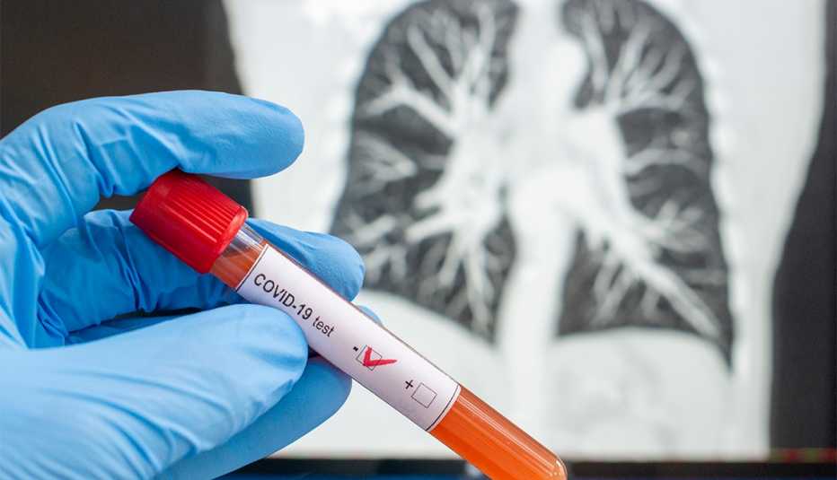 Mano con guantes sostiene un tubo de ensayo y al fodon una radiografía de unos pulmones