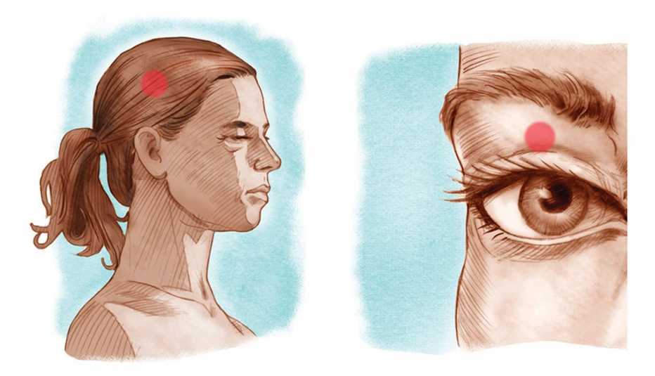 Imflamación del cerebro