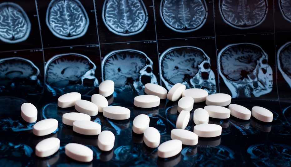 Pastillas blancas y sobre una resonancia magnética de un cerebro