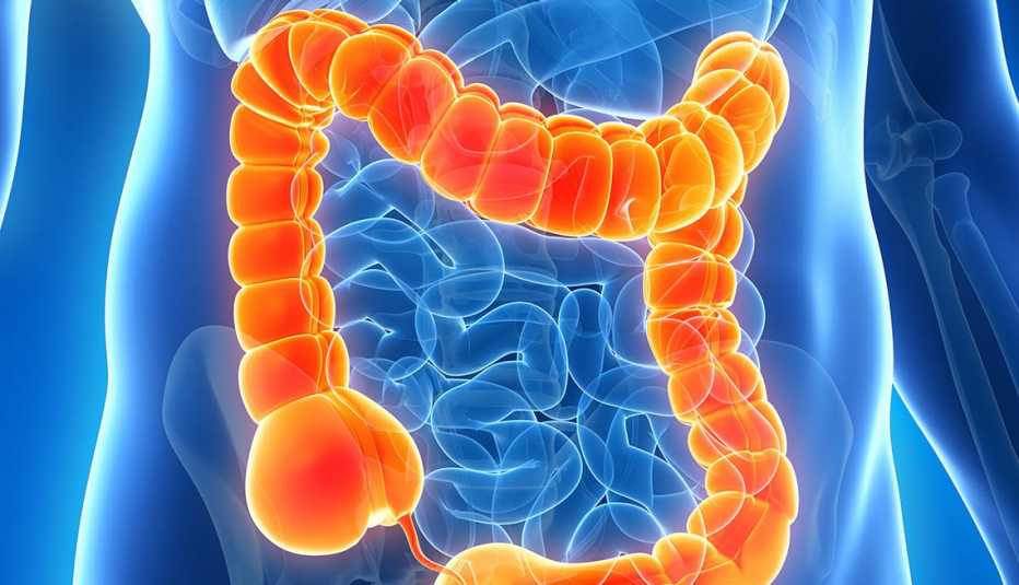 Ilustración del intestino grueso Ilustración del intestino grueso