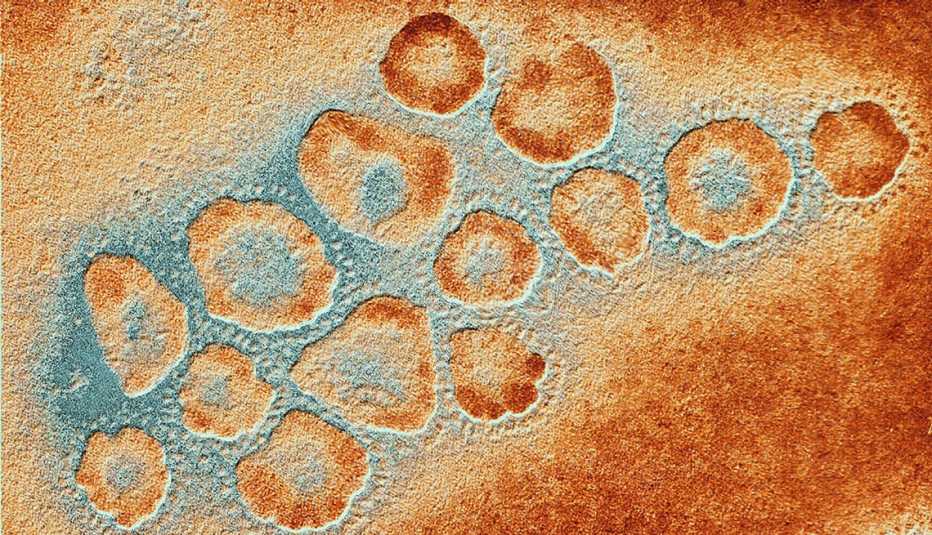 Virus mers