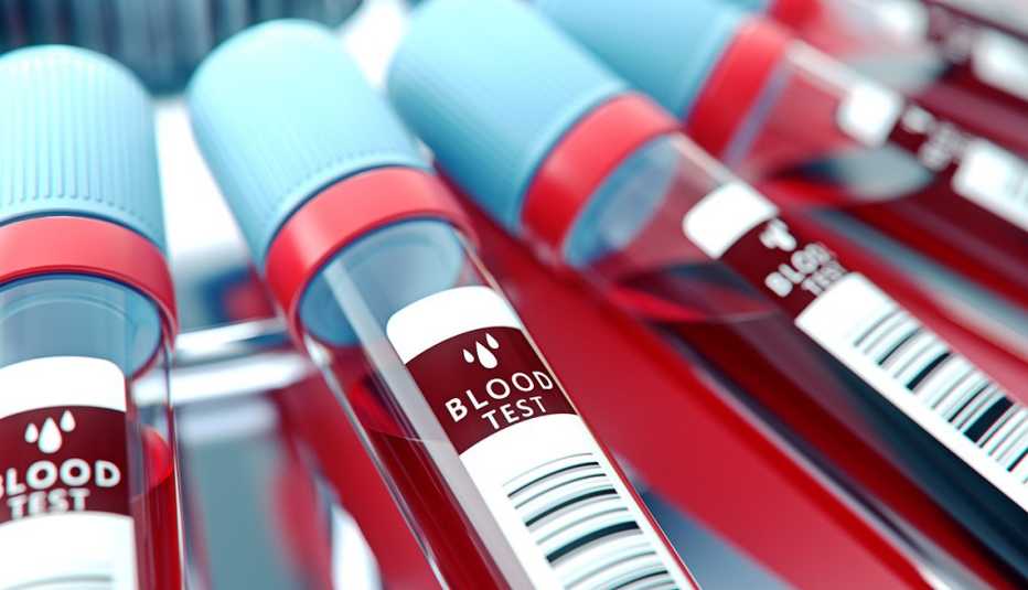 Pruebas de sangre en centrífuga de laboratorio