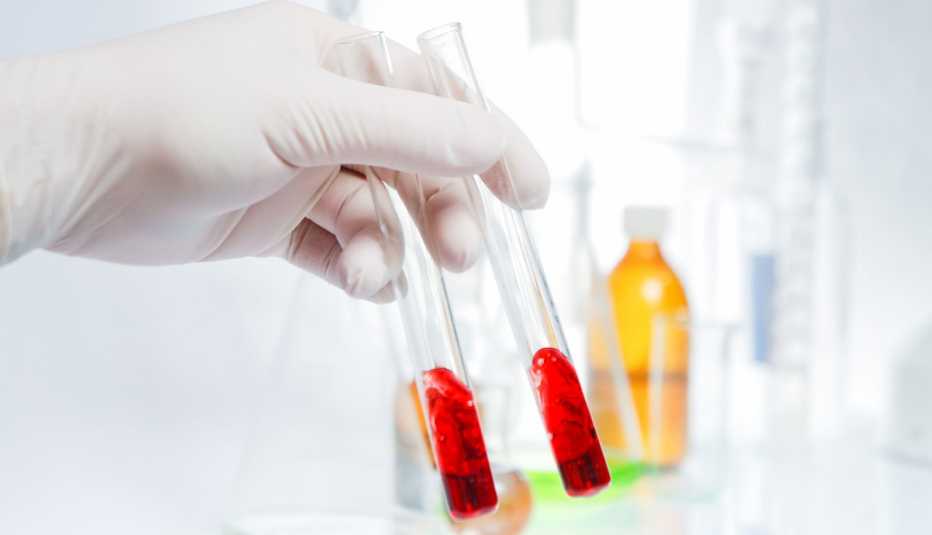 Tubos de ensayo con muestras de sangre