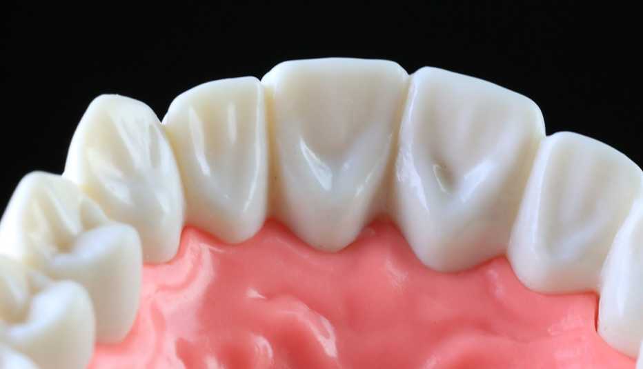 Modelo a escala de encías saludables y dientes