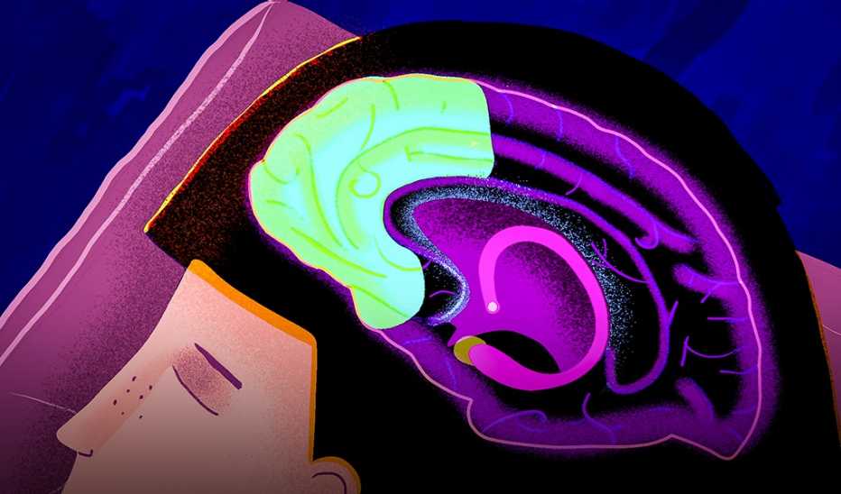 An illustration of a person's brain while they're sleeping